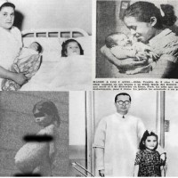 Melahirkan di Usia 5 Tahun Lina Medina Menjadi Ibu Termuda di Dunia
