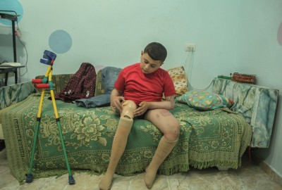 Bocah ini kembali kerumah setelah Kehilangan Ibu, 4 saudara, dan kaki kiri karena Rudal Israel
